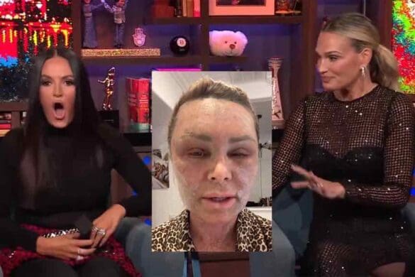 Model Molly Sims talked RHOSLC star Lisa Barlow out of getting the same laser treatment as RHOC's Tamra Judge on WWHL