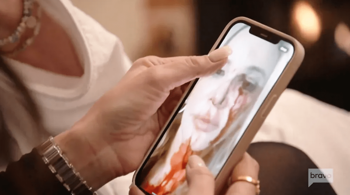 Shannon Beador shows off bloody face from DUI on this week's episode of RHOC. 