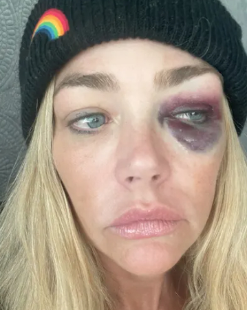 Denise Richards Granted Restraining Order After Allegedly Being Choked, Abused and Threatened by Estranged Husband