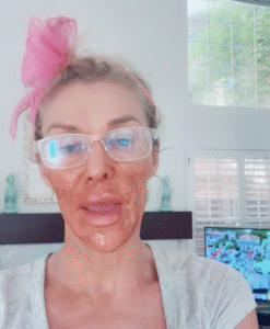 Brandi Glanville Dubs Her Facial Parasite "Caroline" After ‘Housewives’ Feud