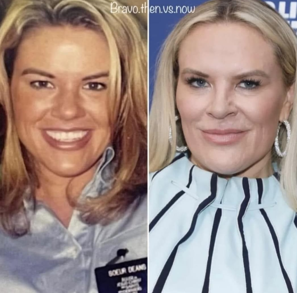 PHOTOS: Heather Gay Details the $200K in Cosmetic Procedures She Says She’s Spent and Why She Has “No Shame” About It 7 PHOTOS: Heather Gay Details the $200K in Cosmetic Procedures She Says She’s Spent and Why She Has “No Shame” About It