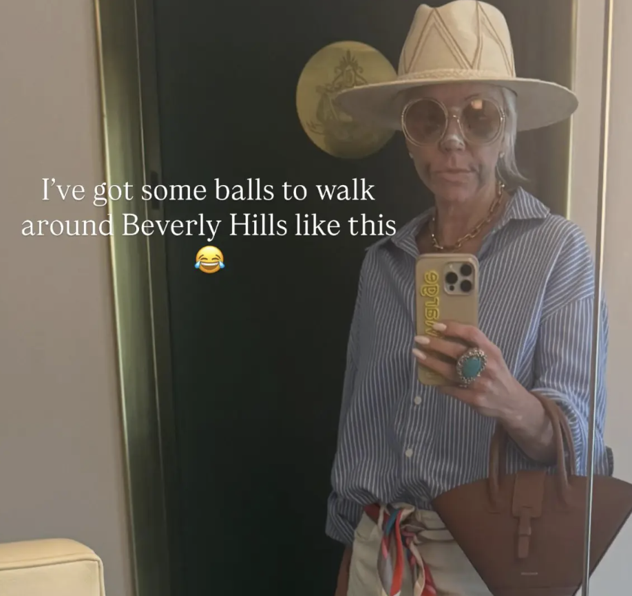 Margaret Josephs Shows Off Bruised Post-Op Photos After Getting a Nose Job