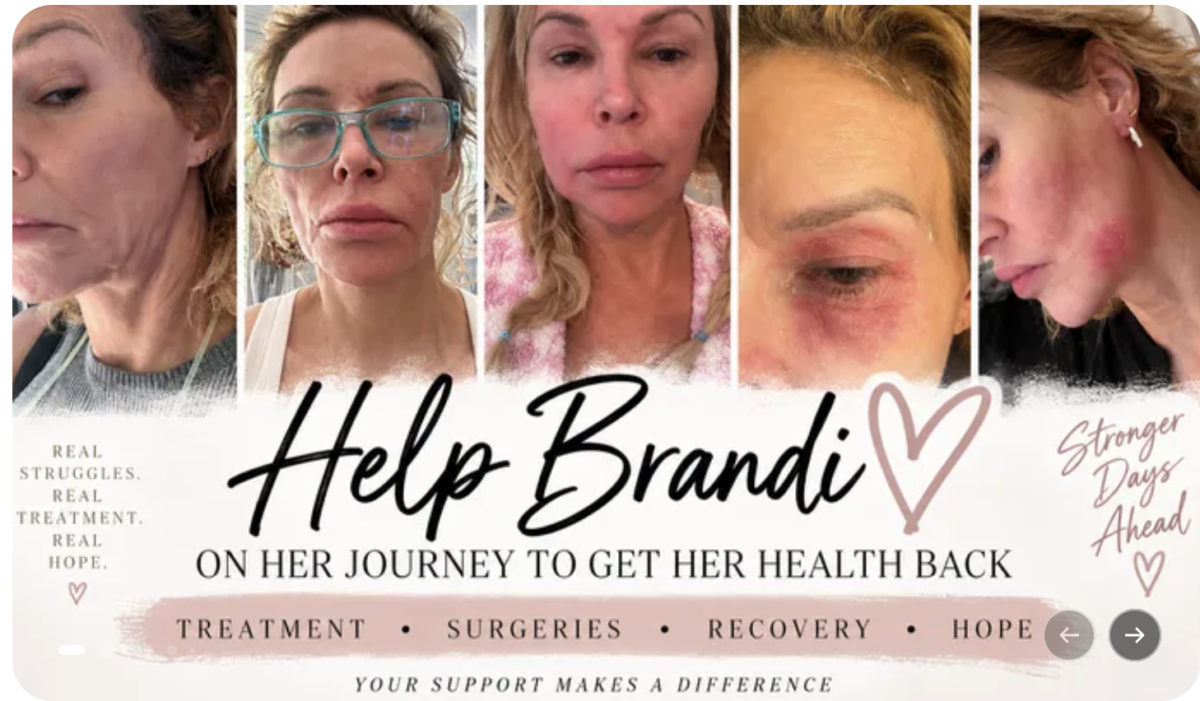 Kyle Richards, Vicki Gunvalson And Other Real Housewives Stars Donate To Brandi Glanville’s GoFundMe Amid Health Battle