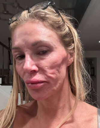 Kelly Dodd Says Brandi Glanville “Doesn’t Deserve A Dime” And Questions Where Her GoFundMe Money Is Really Going Saying She Looks Like She's On Meth